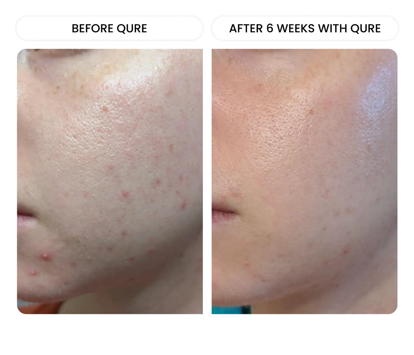 All-In-One Face Serum 4 Month Bundle