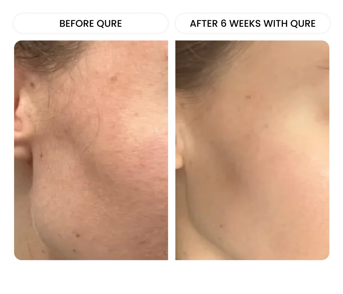 All-In-One Face Serum 6 Month Bundle