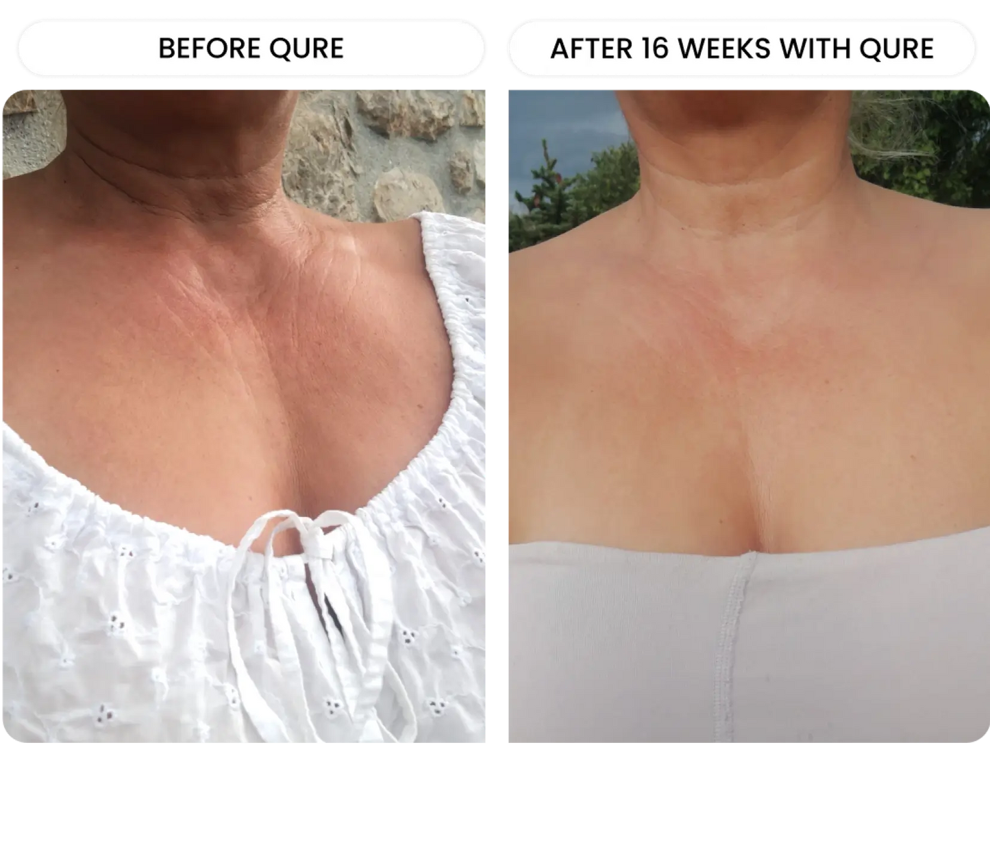 Neck & D¨¦colletage System