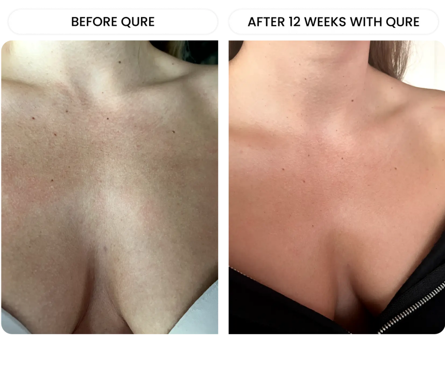 Neck & D¨¦colletage System