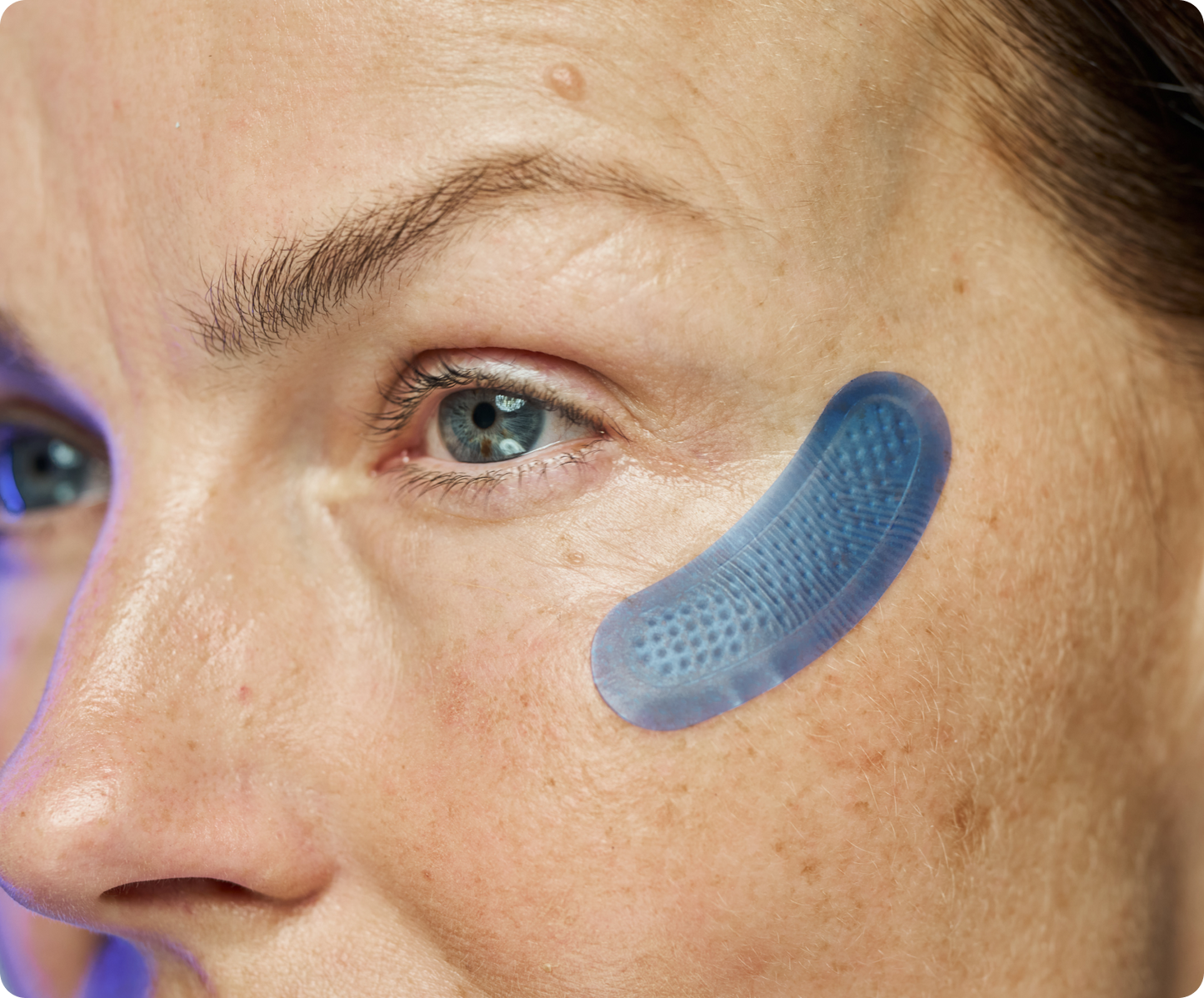 Micro-Infusion Targeted Patches (8 Pairs)
