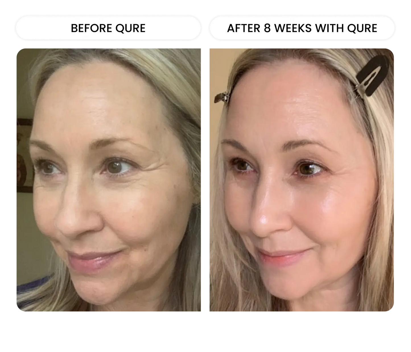 Q-Rejuvalight Pro facewear