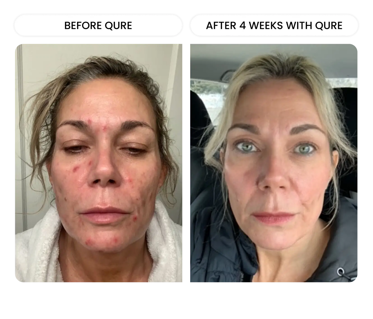 Q-Rejuvalight Pro facewear